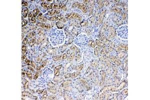 IHC analysis of Glycerol kinase using anti-Glycerol kinase antibody . (Glycerol Kinase antibody  (AA 1-180))