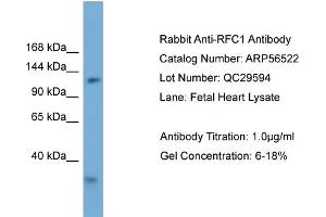 WB Suggested Anti-RFC1  Antibody Titration: 0. (RFC1 antibody  (Middle Region))