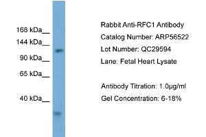 Western Blotting (WB) image for anti-Replication Factor C (Activator 1) 1, 145kDa (RFC1) (Middle Region) antibody (ABIN2786753)
