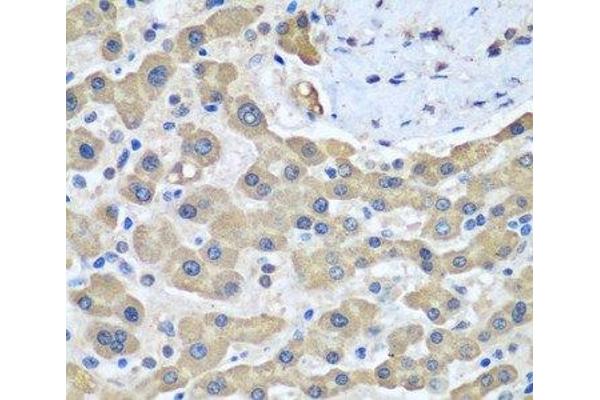 GFM1 antibody
