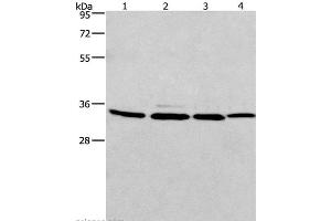 Western Blot analysis of A549, 231, PC3 and hela cell using MAD2L1BP Polyclonal Antibody at dilution of 1:675 (MAD2L1BP antibody)