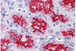 Human Kidney: Formalin-Fixed, Paraffin-Embedded (FFPE) (Peroxiredoxin 4 antibody  (AA 51-151))