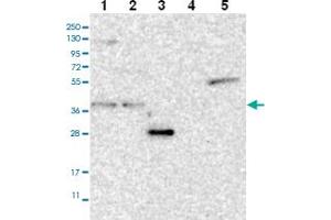 Western blot analysis of Lane 1: RT-4 Lane 2: U-251 MG Lane 3: Human Plasma Lane 4: Liver Lane 5: Tonsil with ST3GAL6 polyclonal antibody . (ST3GAL6 antibody)