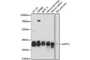 Western blot analysis of extracts of various cell lines, using LEFTY1 antibody. (LEFTY1 antibody)
