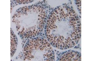 Figure. (TARDBP antibody  (AA 104-262))