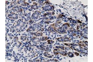 Immunohistochemical staining of paraffin-embedded Human breast tissue using anti-CRYM mouse monoclonal antibody.
