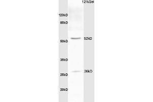 Rat brain lysate probed with Anti Bcl-xL/BCL2L1/bcl-xs Polyclonal Antibody, Unconjugated (ABIN675129) at 1:200 overnight at 4 °C. (BCL2L1 antibody  (AA 81-200))