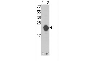 Western blot analysis of IL1RN using rabbit polyclonal IL1RN Antibody using 293 cell lysates (2 ug/lane) either nontransfected (Lane 1) or transiently transfected with the IL1RN gene (Lane 2). (IL1RN antibody  (AA 100-129))