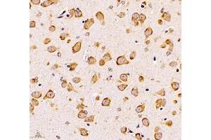 Immunohistochemistry of paraffin embedded mouse brain using UQCC (ABIN7076094) at dilution of 1: 1000 (400x lens) (Ubiquinol-Cytochrome C Reductase Complex Chaperone (UQCC) antibody)