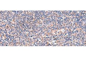 Immunohistochemistry of paraffin-embedded Human tonsil tissue using OSBPL2 Polyclonal Antibody at dilution of 1:55(x200) (OSBPL2 antibody)