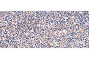 Immunohistochemistry of paraffin-embedded Human tonsil tissue using OSBPL2 Polyclonal Antibody at dilution of 1:55(x200)