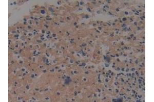 Immunohistochemistry (IHC) image for anti-Prothrombin Fragment 1+2 (F1+2) antibody (ABIN7437446)