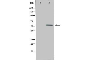 Western blot analysis of extracts from HepG2 cells, using UEVLD antibody.