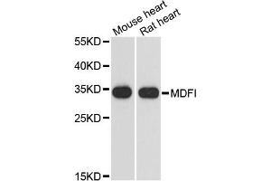 Western blot analysis of extracts of various cell lines, using MDFI antibody. (MDFI antibody)