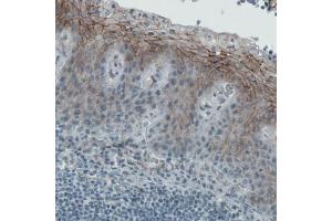Immunohistochemical staining (Formalin-fixed paraffin-embedded sections) of human tonsil with OCLN monoclonal antibody, clone CL1567  shows membranous immunoreactivity in squamous epithelium cells.
