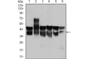Western blot analysis using CDK2 antibody against Jurkat (1), HL-60 (2), K562 (3), A431 (4), HeLa (5), and NIH3T3 (6) cell lysate. (CDK2 antibody)
