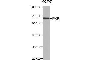 Western blot analysis of extracts of MCF-7 cell line, using PKR antibody. (EIF2AK2 antibody)