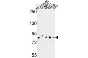 Western Blotting (WB) image for anti-Chondroitin Polymerizing Factor (CHPF) antibody (ABIN3004012) (CHPF antibody)
