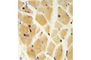 Immunohistochemistry analysis in formalin fixed and paraffin embedded skeletal muscle reacted with GCLM / GLCLR Antibody (C-term) followed by peroxidase conjugation of the secondary antibody and DAB staining.