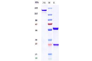 Anti-TREM1 / CD354 Reference Antibody (PY159) on SDS-PAGE under reducing (R) condition. (Recombinant TREM1 antibody)