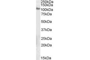 Western Blotting (WB) image for anti-Integrin beta 5 (ITGB5) (C-Term) antibody (ABIN2465852) (Integrin beta 5 antibody  (C-Term))