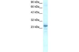 Human Heart; WB Suggested Anti-NKX2-8 Antibody Titration: 0. (NKX2-8 antibody  (C-Term))