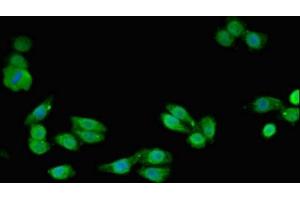 Immunofluorescent analysis of HepG2 cells using ABIN7170866 at dilution of 1:100 and Alexa Fluor 488-congugated AffiniPure Goat Anti-Rabbit IgG(H+L) (SMC4 antibody  (AA 406-501))
