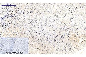 Immunohistochemical analysis of paraffin-embedded human liver tissue. (MEK1/2 antibody  (pSer218, pSer222))