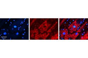 Rabbit Anti-UGT2B4 Antibody   Formalin Fixed Paraffin Embedded Tissue: Human heart Tissue Observed Staining: Cytoplasmic Primary Antibody Concentration: 1:100 Other Working Concentrations: 1:600 Secondary Antibody: Donkey anti-Rabbit-Cy3 Secondary Antibody Concentration: 1:200 Magnification: 20X Exposure Time: 0. (UGT2B4 antibody  (N-Term))