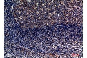 Immunohistochemistry (IHC) analysis of paraffin-embedded Human Tonsils, antibody was diluted at 1:100. (CD6 antibody  (Internal Region))