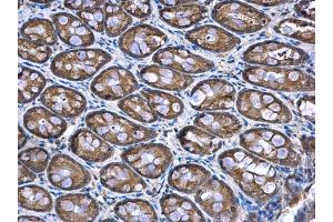 IHC-P Image NDUFA12 antibody [N1C3] detects NDUFA12 protein at mitochondria in rat colon by immunohistochemical analysis. (NDUFA12 antibody  (full length))