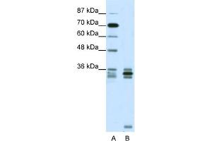 WB Suggested Anti-OLIG2 Antibody Titration: 0. (OLIG2 antibody  (C-Term))