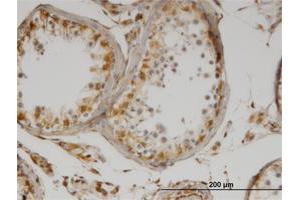 Immunoperoxidase of monoclonal antibody to IL13 on formalin-fixed paraffin-embedded human testis. (IL-13 antibody)