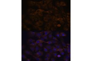 Immunofluorescence analysis of C6 cells using GRSF1 antibody (ABIN7267319) at dilution of 1:100. (GRSF1 antibody)