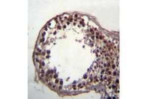 Formalin fixed, paraffin embedded human testis tissue stained with DAZ3 (C-term) followed by peroxidase conjugation of the secondary antibody and DAB staining. (DAZ3 antibody  (C-Term))