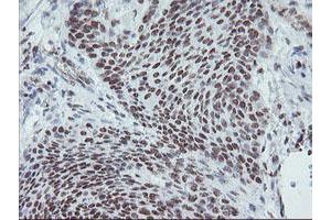 Image no. 5 for anti-Myeloid Leukemia Factor 1 (MLF1) antibody (ABIN1499493)