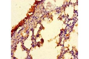 Immunohistochemistry of paraffin-embedded human lung tissue using ABIN7147754 at dilution of 1:100 (C9orf117 antibody  (AA 1-200))