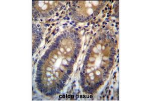 ASMTL Antibody (Center) (ABIN657160 and ABIN2846294) immunohistochemistry analysis in formalin fixed and paraffin embedded human colon tissue followed by peroxidase conjugation of the secondary antibody and DAB staining. (ASMTL antibody  (AA 231-259))