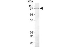 Western Blot Analysis of KIAA1524 in HeLa whole cell lysate using KIAA1524 monoclonal antibody, clone 2G10 .