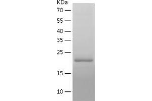 Western Blotting (WB) image for Peptidylprolyl Isomerase A (Cyclophilin A) (PPIA) (AA 1-164) protein (His tag) (ABIN7285516) (PPIA Protein (AA 1-164) (His tag))