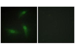 Immunofluorescence analysis of HeLa cells, using hnRNP A1 antibody. (HNRNPA1 antibody  (Internal Region))