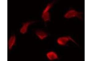 ABIN6275530 staining HepG2 by IF/ICC. (NEK5 antibody  (Internal Region))