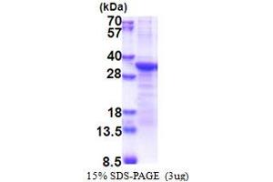 SDS-PAGE (SDS) image for Proprotein Convertase Subtilisin/kexin Type 1 Inhibitor (PCSK1N) (AA 34-260) protein (His tag) (ABIN6387353)