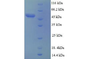 SDS-PAGE (SDS) image for CD40 Ligand (CD40LG) (AA 47-258), (Extracellular) protein (GST tag) (ABIN5712445)