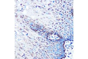 Immunohistochemistry of paraffin-embedded human esophageal using MMP3 Rabbit mAb (ABIN7268424) at dilution of 1:100 (40x lens). (MMP3 antibody)