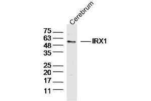 Mouse Cerebrum lysates probed with IRX1 Polyclonal Antibody, Unconjugated  at 1:300 dilution and 4˚C overnight incubation. (IRX1 antibody  (AA 401-480))