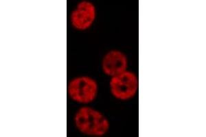 ABIN6276566 staining  Hela cells by IF/ICC. (NEDD8 antibody  (Internal Region))