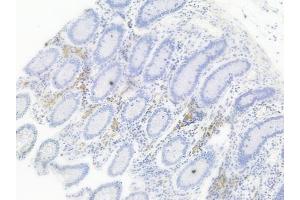 ABIN6256561 and ABIN6267442 at 1/100 staining human normal colon tissue by IHC-P.