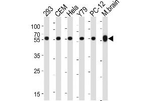 Western blot analysis of lysates from 293, CEM, Hela, Y79, rat PC-12 cell line, mouse brain tissue lysate(from left to right), using TBB5 Antibody (ABIN387758 and ABIN2838008). (TUBB antibody)
