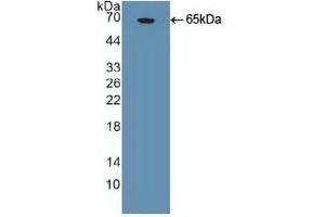 Western blot analysis of recombinant Huma NANOG.